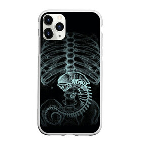 Чехол для iPhone 11 Pro матовый с принтом Чужой на Рентгене в Рязани, Силикон |  | Тематика изображения на принте: alien | больница | больной | внутренний мир | врач | клиника | кости | пациент | ребра | рентген | скелет | снимок | хищник