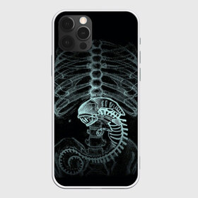 Чехол для iPhone 12 Pro Max с принтом Чужой на Рентгене в Рязани, Силикон |  | Тематика изображения на принте: alien | больница | больной | внутренний мир | врач | клиника | кости | пациент | ребра | рентген | скелет | снимок | хищник