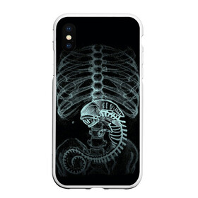 Чехол для iPhone XS Max матовый с принтом Чужой на Рентгене в Рязани, Силикон | Область печати: задняя сторона чехла, без боковых панелей | Тематика изображения на принте: alien | больница | больной | внутренний мир | врач | клиника | кости | пациент | ребра | рентген | скелет | снимок | хищник